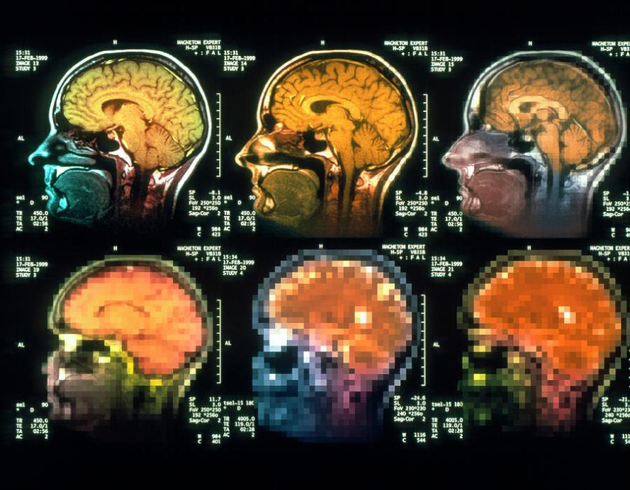How Are Brain Disorders Diagnosed?