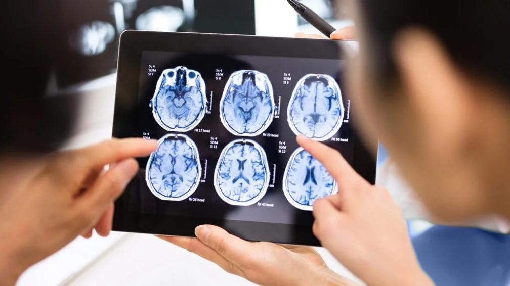 How Will I Receive The Results Of My Child's Brain Imaging Scan?