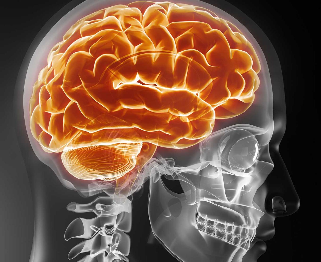 How Can Brain Imaging Help Us Understand Mental Illness?