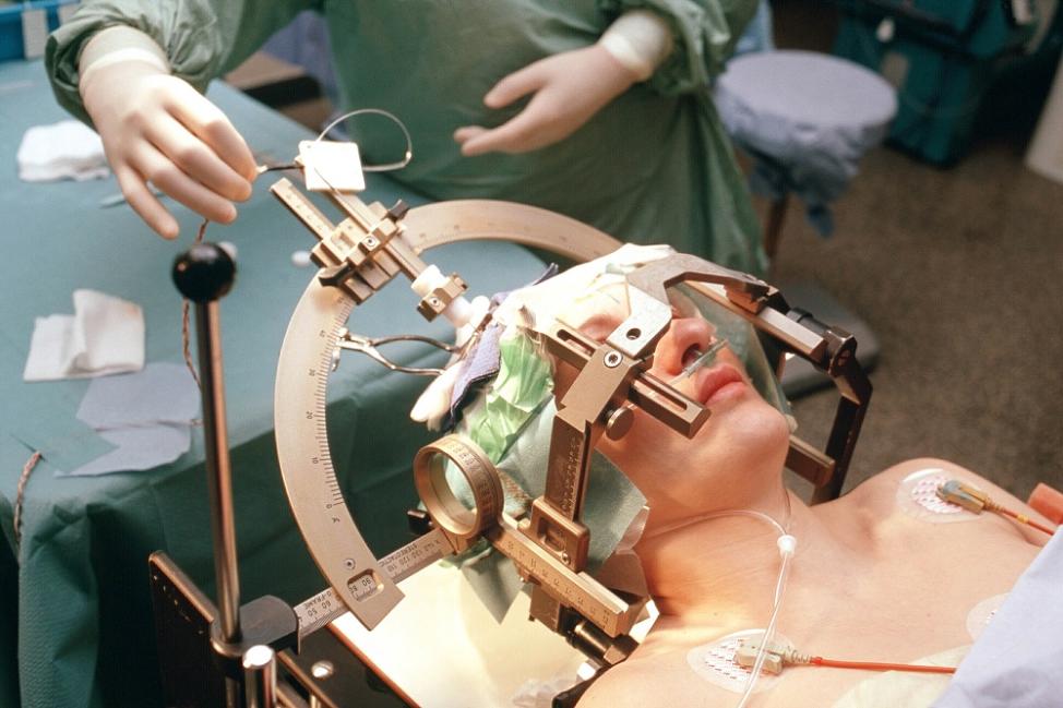 How Has Brain Surgery Evolved Over the Past Century?